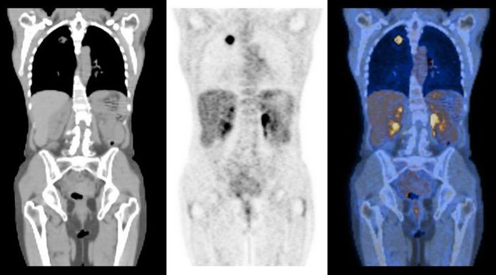 Imagerie Médicale 10 ans d'Arronax